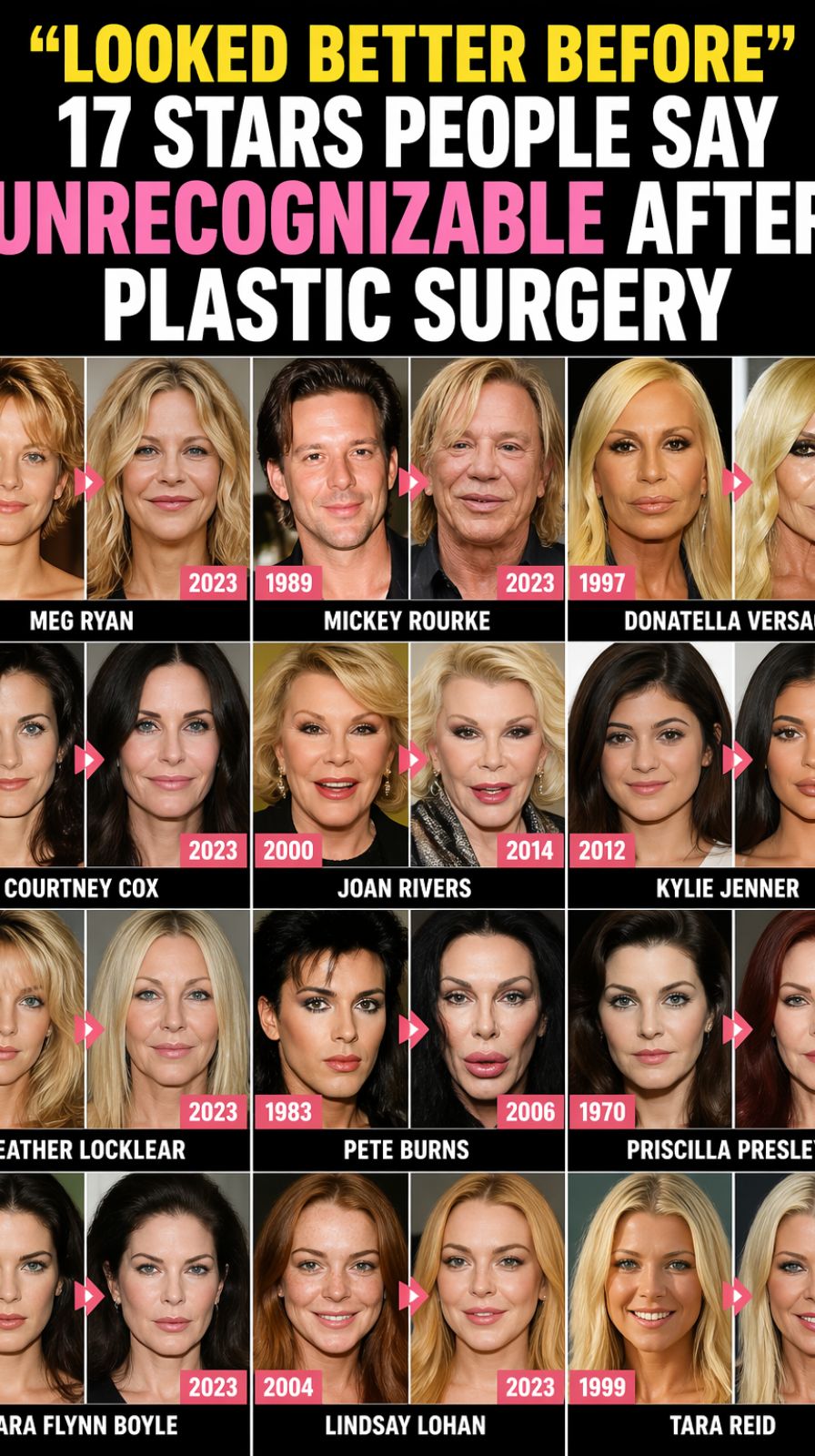 “Looked Better Before”: 17 Stars People Say Look Unrecognizable After Plastic Surgery